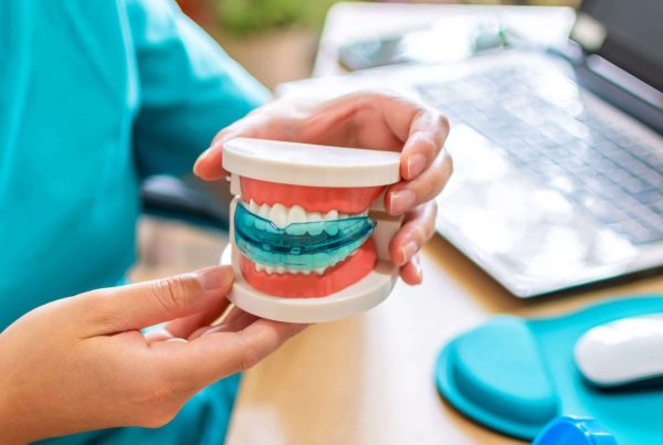 custom-fit mouthguard